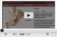 Multimedia Patient Education - Sydney Hip and Knee - Dr.Michael Solomon Dr.David Broe